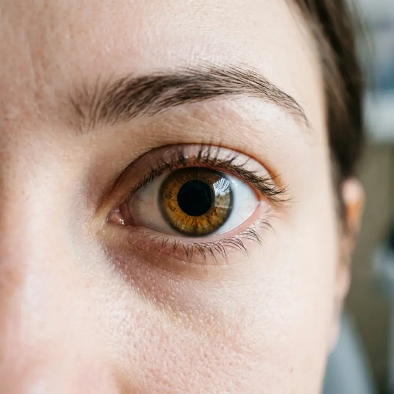 Dilated Pupils: Causes and What They Indicate